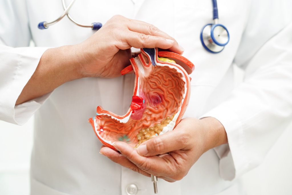 Καρκίνος του στομάχου: Τα 5 προειδοποιητικά σημάδια που δύσκολα αναγνωρίζουμε