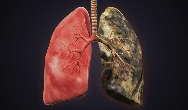 Τι κάνει το τσιγάρο στους πνεύμονες: Το βίντεο που σόκαρε τους καπνιστές παγκοσμίως