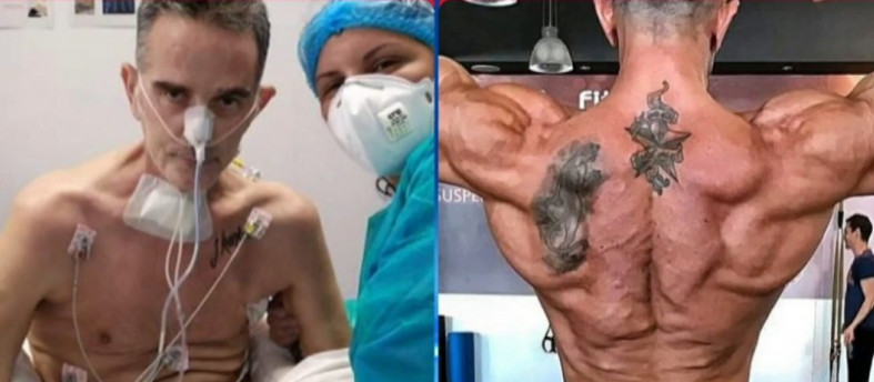 Παγκόσμιος πρωταθλητής body building έχασε 42 κιλά – Έμεινε διασωληνωμένος δύο μήνες λόγω κορονοϊού