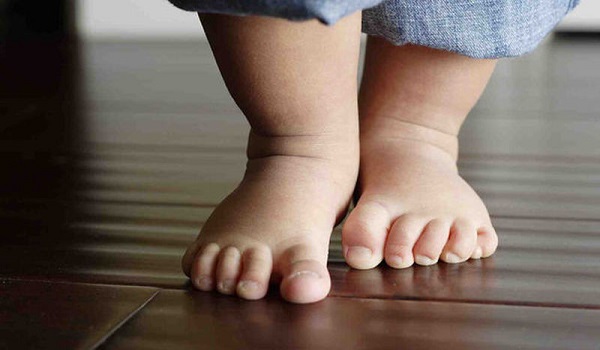 Πλατυποδία παιδιού και στροφή των ποδιών προς τα μέσα: Τι πρέπει να γνωρίζουν οι γονείς