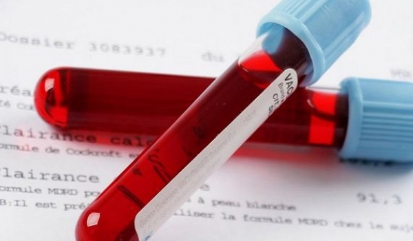 Galleri: Τεστ αίματος ανιχνεύει πάνω από 50 είδη καρκίνου πριν την εμφάνιση συμπτωμάτων