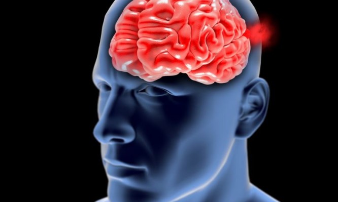 Ανεύρυσμα στον εγκέφαλο: Τα πρώιμα συμπτώματα που πρέπει να ξέρετε