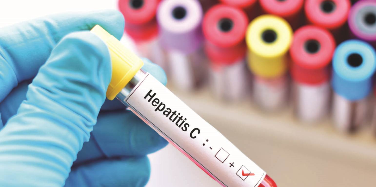 Eξαρση της οξείας ηπατίτιδας σε παιδιά: Φόβοι για νέα επιδημία