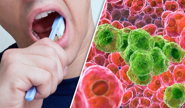 Ο καρκίνος του οισοφάγου συνδέεται με το βούρτσισμα των δοντιών - Δείτε τι συμβαίνει