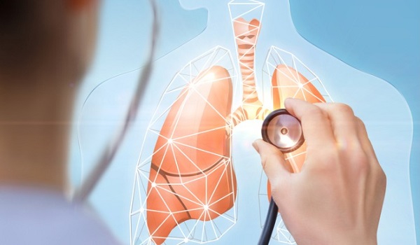 Καρκίνος του πνεύμονα: Πώς μπορεί να συμβεί σε όσους ΔΕΝ καπνίζουν
