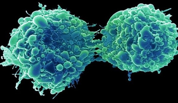 Καρκίνος της ουροδόχου κύστης: Πώς σχετίζεται με το κοινό κρυολόγημα