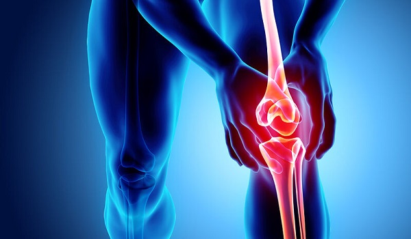 Οστεοαρθρίτιδα γόνατος: Ποια νόσος προμηνύει την εμφάνισή της;