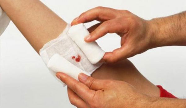 Πώς να φροντίσετε πληγές και κοψίματα για να μην αφήσουν σημάδι στο δέρμα