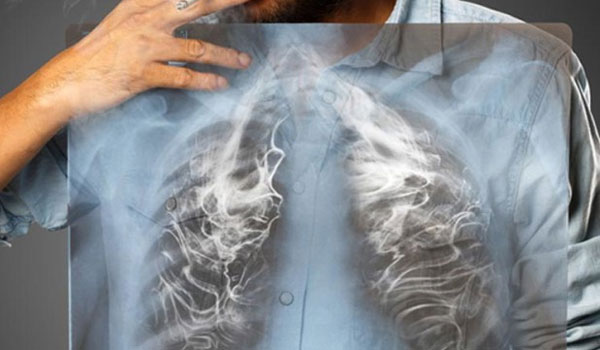 Σε πόσο καιρό θα καθαρίσουν οι πνεύμονες, αν κόψετε σήμερα το κάπνισμα