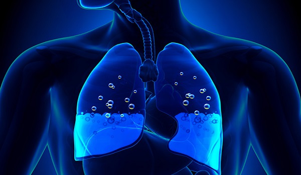 Τα μικρά συμπτώματα που δείχνουν συσσώρευση υγρού στον πνεύμονα