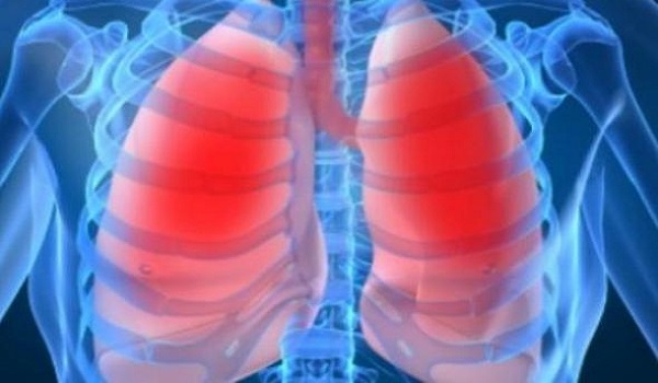 Συστατικό σε πασίγνωστη τροφή μπορεί να βοηθήσει απέναντι στον καρκίνο του πνεύμονα