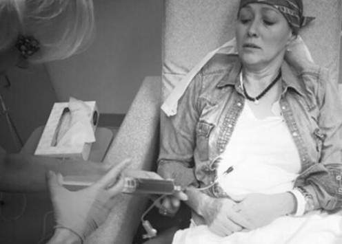 Σοκάρει η Shannen Doherty με τις φωτογραφίες από την χημειοθεραπεία