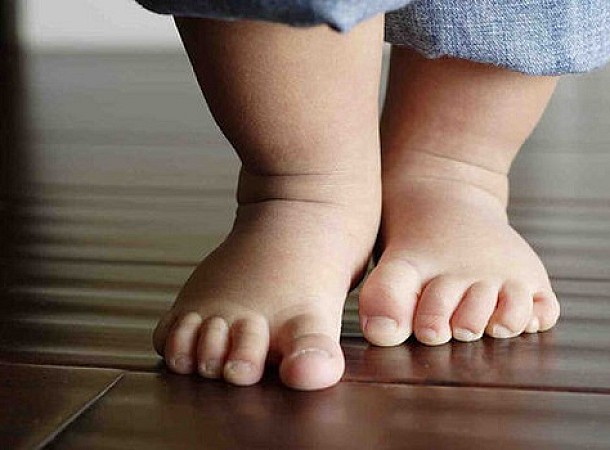 Πλατυποδία παιδιού και στροφή των ποδιών προς τα μέσα: Τι πρέπει να γνωρίζουν οι γονείς