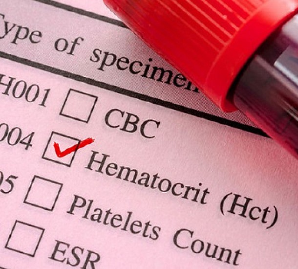 Θα κάνεις αιματολογικές εξετάσεις χοληστερίνης; Να τι μπορείς να φας το προηγούμενο βράδυ