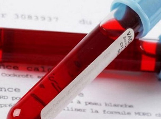 Johns Hopkins: Νέα αιματολογική εξέταση μπορεί να ανιχνεύσει τον καρκίνο