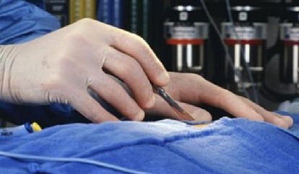 Σοκάρουν οι φωτογραφίες της 38χρονης που καταγγέλλει γνωστό πλαστικό χειρουργό για παραμόρφωση